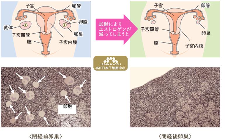 恩城日本干细胞中心-更年期身体的变化及日本经血干细胞改